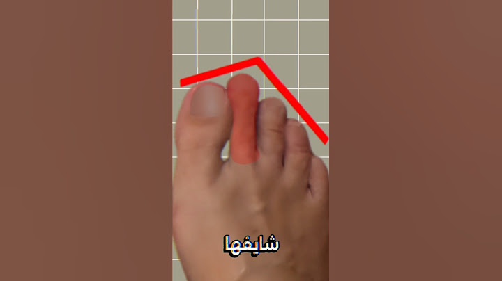 ‏شخصيتك من أصابع القدم