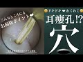 142 #耳掃除 #耳かき #earwax【#耳瘻孔 発見！すぽっとポイント、何回かあります】