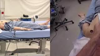 Direct Laryngoscopy Split Screen