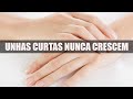 8 razões pelas quais suas unhas curtas nunca crescem