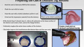 Complete Denture Reline & Rebase/Immediate Denture Surgical Template