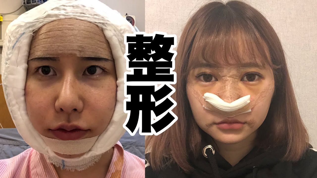 今日は整形について熱く語り合う