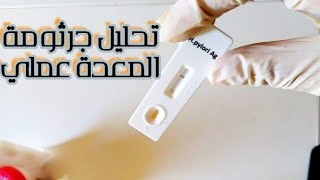 تحليل  جرثومة المعدة عملي helicopacter pylori  rapid test