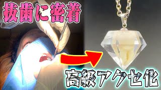 【大抜歯】親知らずを抜いたので完全手作りで『世界に一つのネックレス』にしてみたい！！！