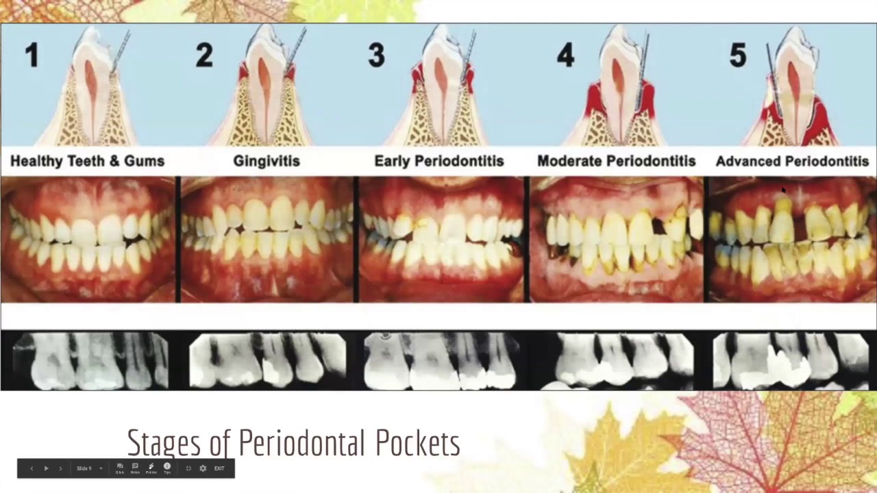 WaterPiks Why You Need One, Which Model to Get, and How to Use It