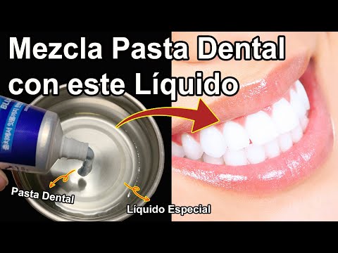Blanquea tus Dientes y Quita Sarros y Placas de tus Dientes en 5 minutos con esta Mezcla <strong>Genial</strong>