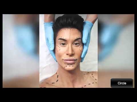 5 არასასიამოვნო პლასტიკური ოპერაცია