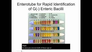 Enterotubes