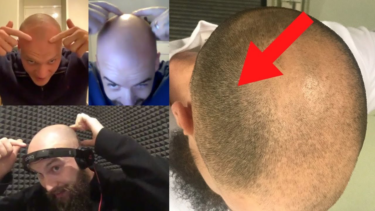 Bald Men Discuss "The Shadow/Horseshoe" How to get comfortable with