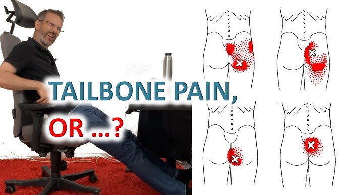 How to Correctly Use the Original McKenzie Coccyx Cushion - Relieve Tailbone  Pain 