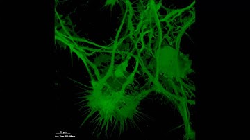 LUHMES   dynamics of the neuronal net and neurite growth cons