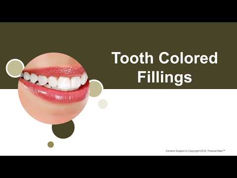 Tooth-Colored Fillings -