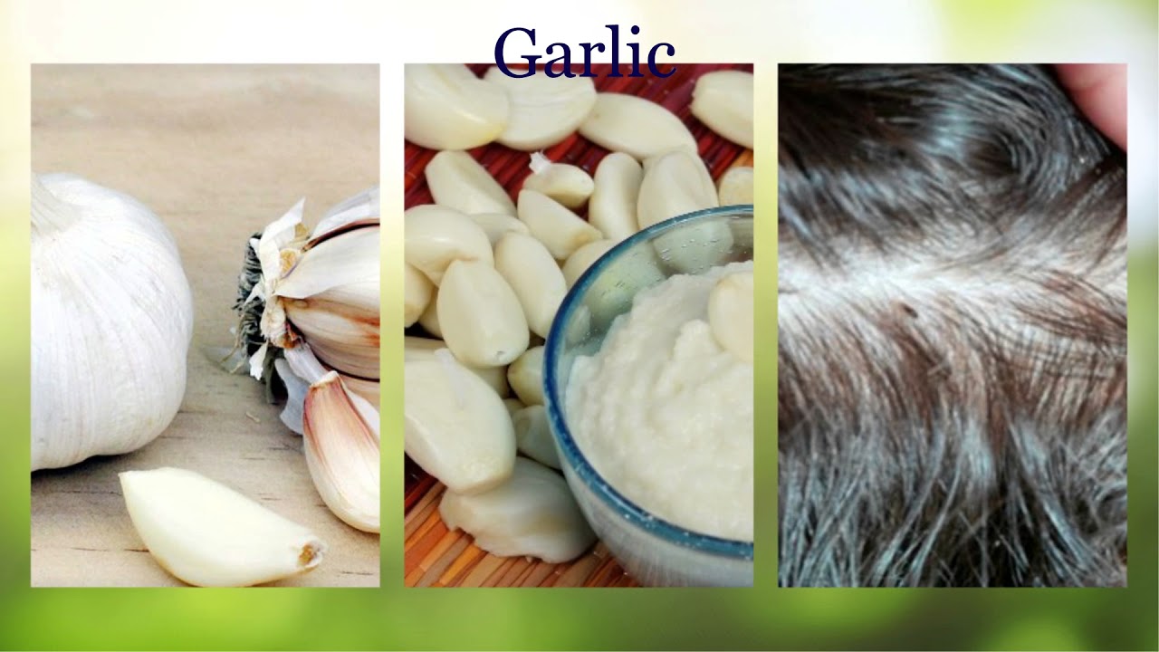 Tips to Get Rid of Head Lice and Nits How to Get Rid of Head Lice