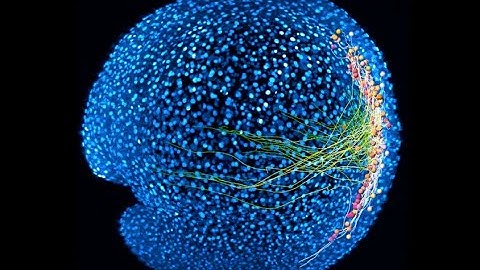 Neurons in spinal circuit