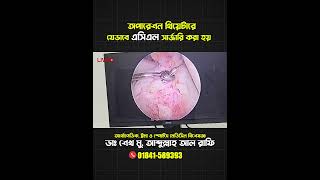 এসিএল সার্জারি: অপারেশন থিয়েটার থেকে || Dr. Rafi || Micare Health &amp; Research
