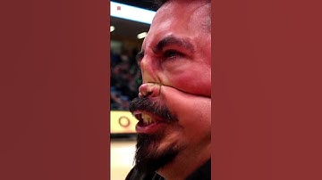 The Weirdest Olympic Game Nose Pulling 😨 #shorts