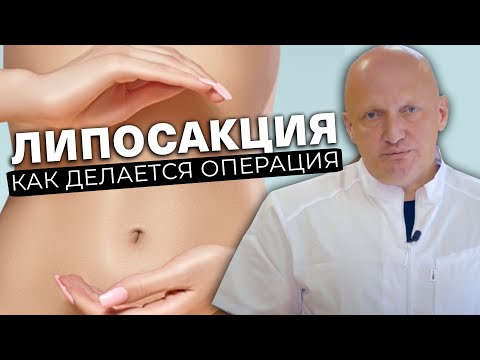 Удалить жир на животе, бёдрах, ягодицах! Липосакция - как делается операция?