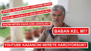 BABAN KEL Mİ? SAÇLARIM NE ZAMAN ÇIKAR? SORULARINIZI YANITLADIK (SORU-CEVAP)