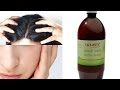 Top 5 ways to use Amla Juice | Benefits of amla juice in skincare haircare & health