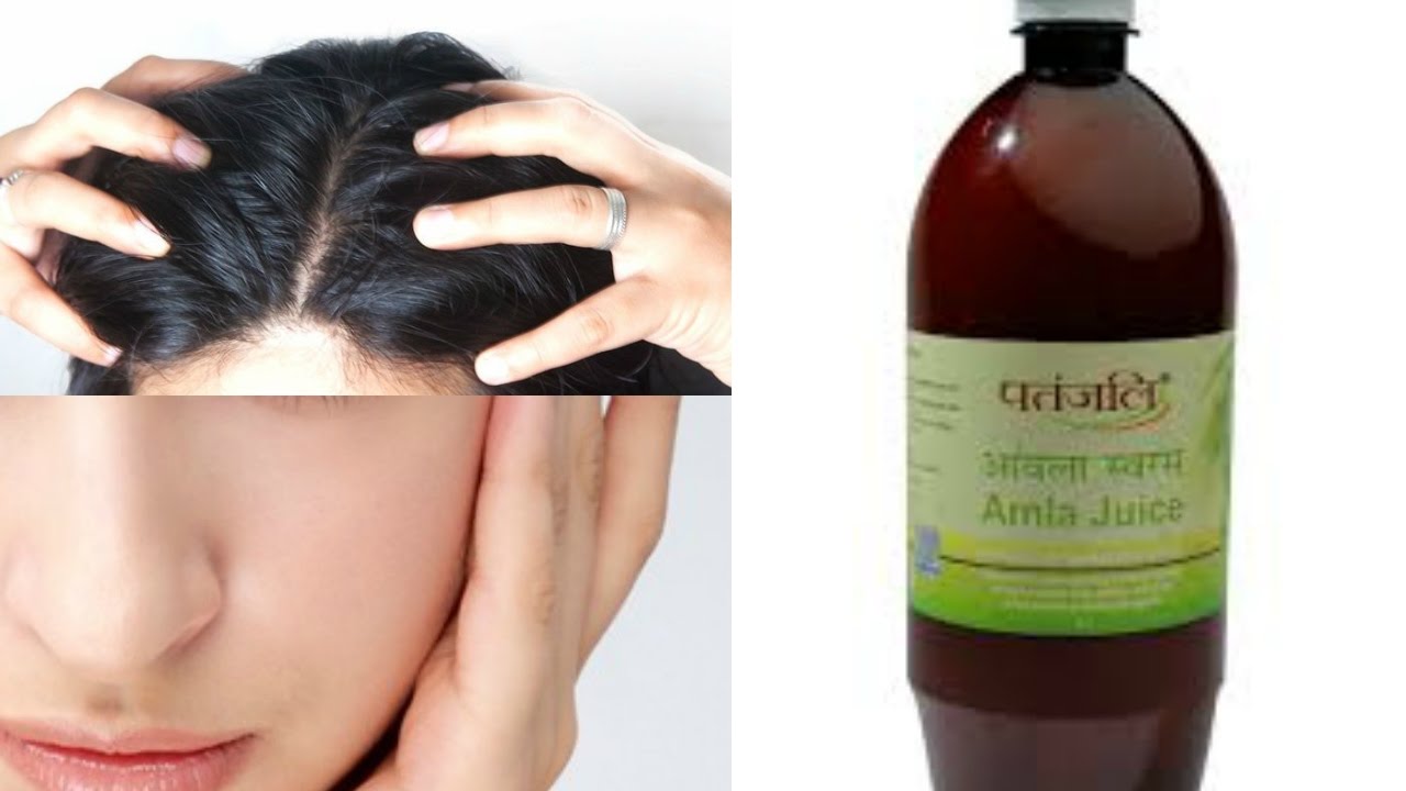 Top 5 ways to use Amla Juice | Benefits of amla juice in skincare haircare  & health - YouTube