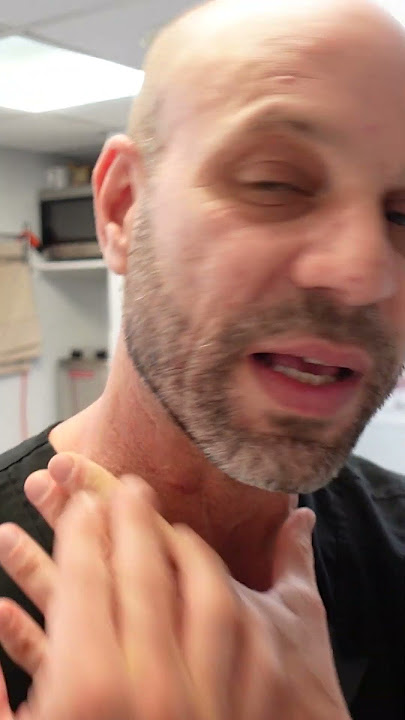 How to Solve Stiff Neck Issues - Muscle Mechanics LTM