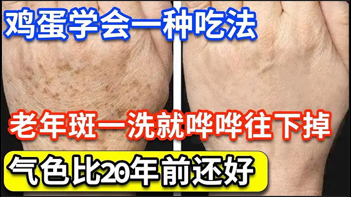 手上脸上都是斑？鸡蛋学会一种吃法，2天后一洗脸黄褐斑、老年斑就哗哗往下掉！气色比20年前还好！【问诊健康】 - 天天要闻