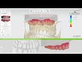 3DBioCAD - 3Shape Ortho Analyzer   How to Import CBCT Scan and Use the CT Preparation Module