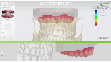 3DBioCAD - 3Shape Ortho Analyzer   How to Import CBCT Scan and Use the CT Preparation Module