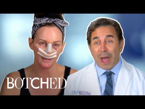Will Lupus Stop Lisa From Getting A 3rd Nose Job?! FULL TRANSFORMATION  Botched  E!