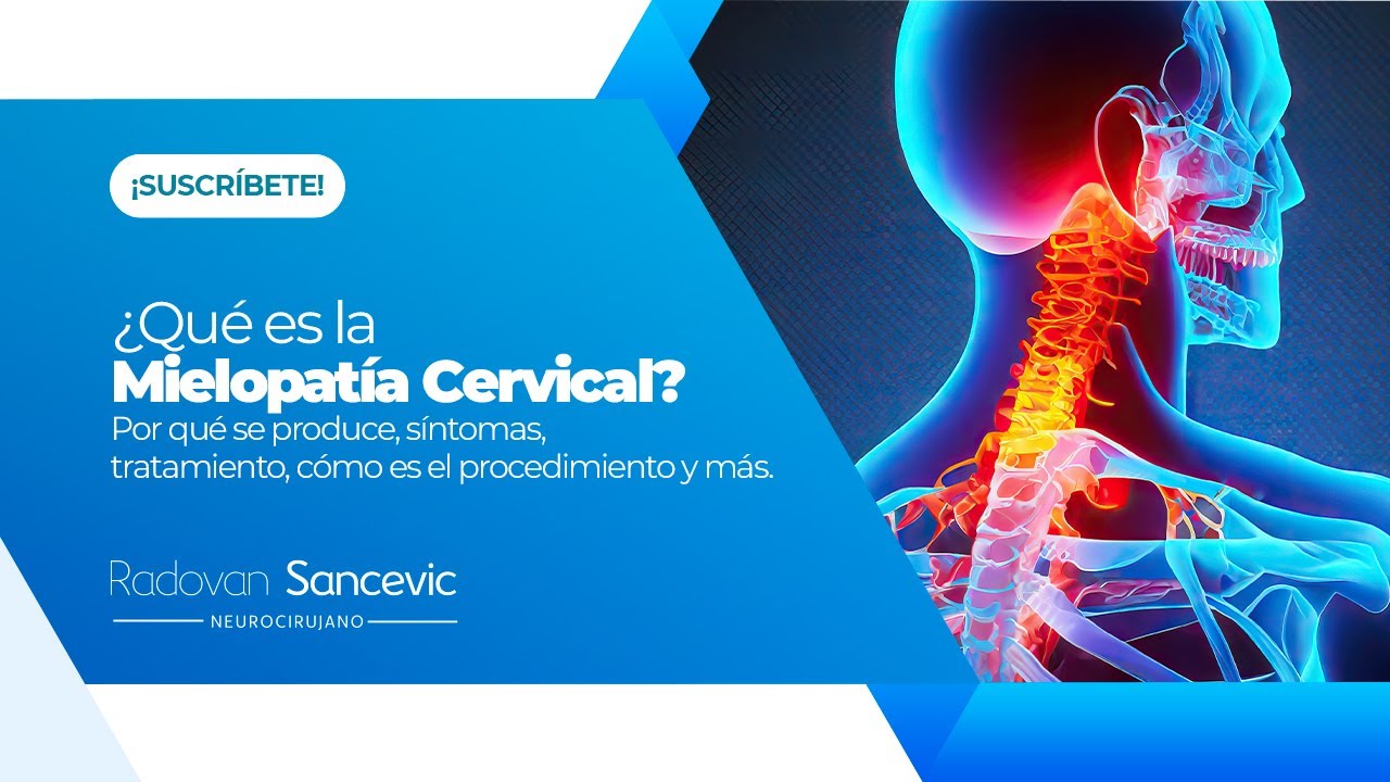 Centro especializado en columna explica mielopatía cervical