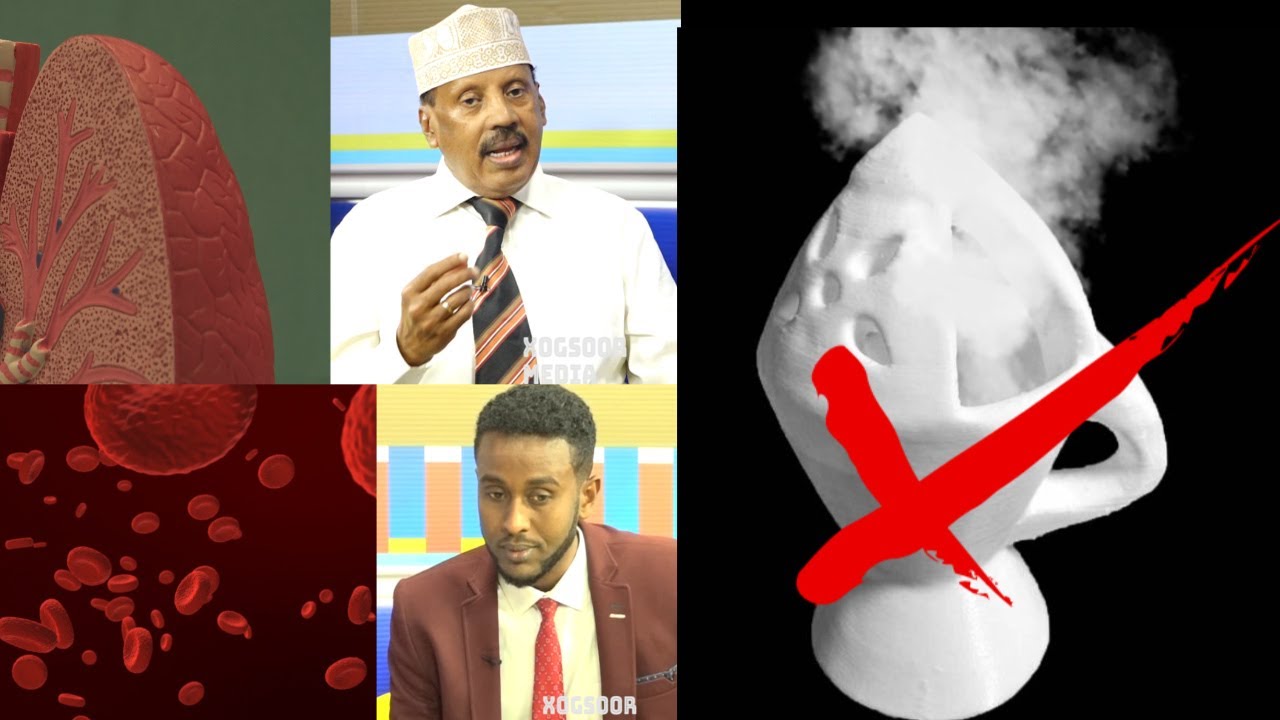 Cudur Dilaa ah oo Laga Qaado Uunsiga, Cuudka iyo Luubaanta Dr Cali Macow iyo Abdiaziiz Really