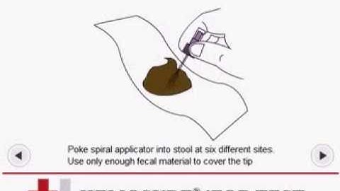 Hemosure iFOBT (FIT) Patient Instructions