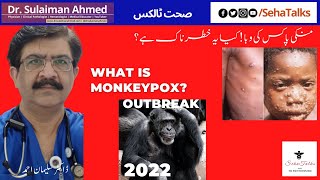 What exactly is Monkeypox? What are the causes and symptoms, \& how is it spread ? Risk for public