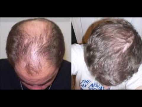 how-long-does-it-take-for-castor-oil-to-grow-your-hair