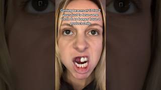 Can Braces Make Your Teeth FALL OUT?!