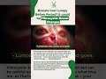 FIBROCYSTIC BREAST CHANGES: BREASTS FEEL LUMPY BEFORE PERIOD? - TheTole Acupuncture & TheTole Herbs
