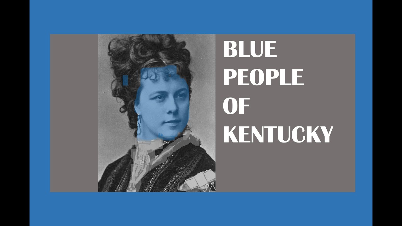 "The Blue People of Kentucky . . .and Me!"