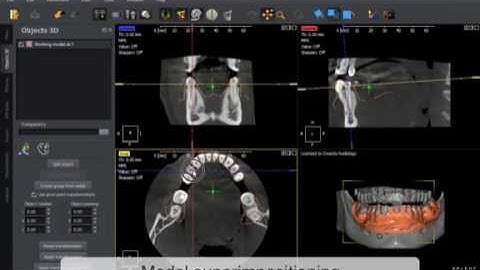 QuickVision 3D  Superimpositioning  OWANDY RADIOLOGY