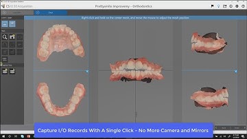 CS Orthotrac, 3600, and CS Model Plus