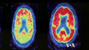 Unlocking Secrets of a Sharp Mind at Old Age