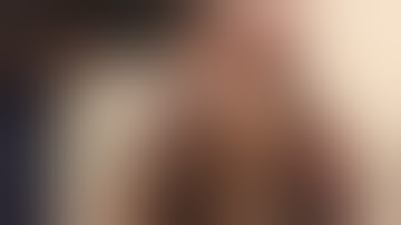 Pneumatic Retinopexy for Rhegmatogenous Retinal Detachment - with Portuguese Subtitles