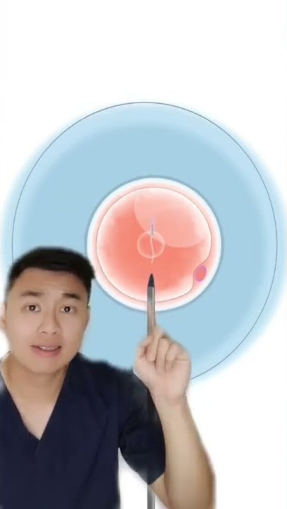 Proses inseminasi buatan! #tipskesehatan #tipspromil #inseminasibuatan