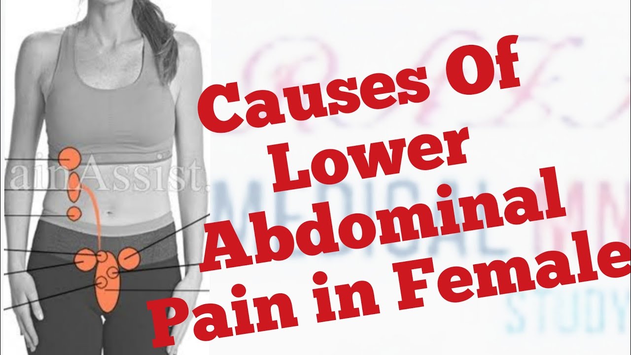 Female Lower Left Abdominal Pain