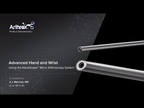 Advanced Hand and Wrist Using the NanoScope™ Micro Arthroscopy System