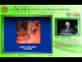 Enfermedad por reflujo gastroesofático-Acad. Dr. Fernando Bernal Sahagun-15Mayo2012