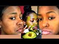 Kuondoa CHUNUSI Usoni Na MAKOVU Kwa Haraka How To Get Rid Of Acne In A WEEK Kuondoa CHUNUSI Usoni Na MAKOVU Kwa Haraka How To Get Rid Of Acne In A WEEK