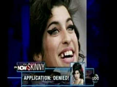 ABC World News Now introduces a story as a train wreck. Shows a less than flattering picture with the singer missing a tooth. Seems condescending? As expected "Sidekick" Ryan Owens and the latest left seat boob Tanya Rivero laugh at the recording artist misfortunes. Is this appalling? The Senior Producer allows this?