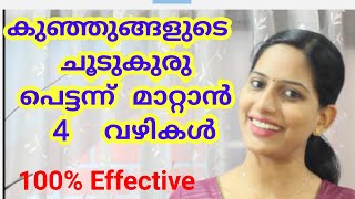 Home remedy to cure heat rashes on babies (Malayalam). Pregnancy & Lactation Series # 38