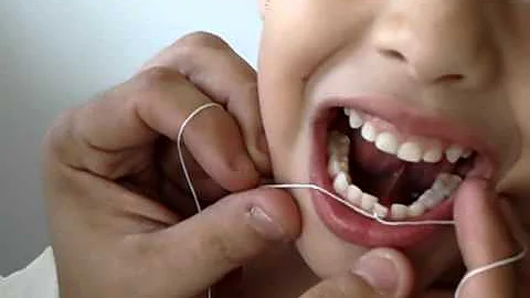 O que fazer com o primeiro dente de leite que caiu?