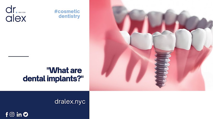 Nyc center for dental implants review năm 2024